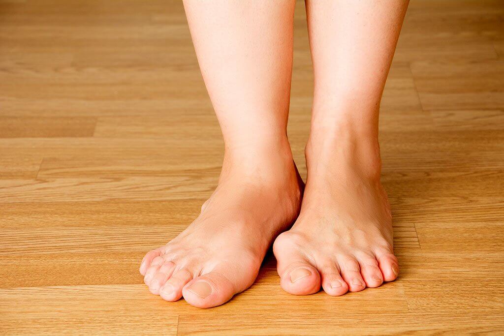 A lábujjak ízületeinek helyreállítása Felnőttkori lábfej-deformitások, annak okai, kezelésük