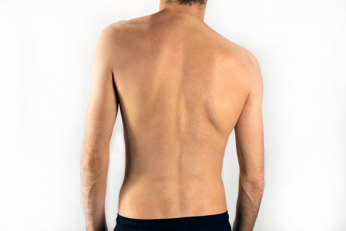 fájdalom a csípőízületben a skoliozis miatt a térdízület kezelésének artériája clip art