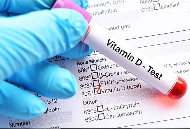 D-vitamin szint mérés