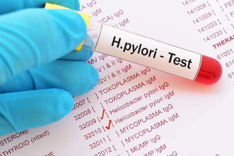 Helicobacter pylori teszt
