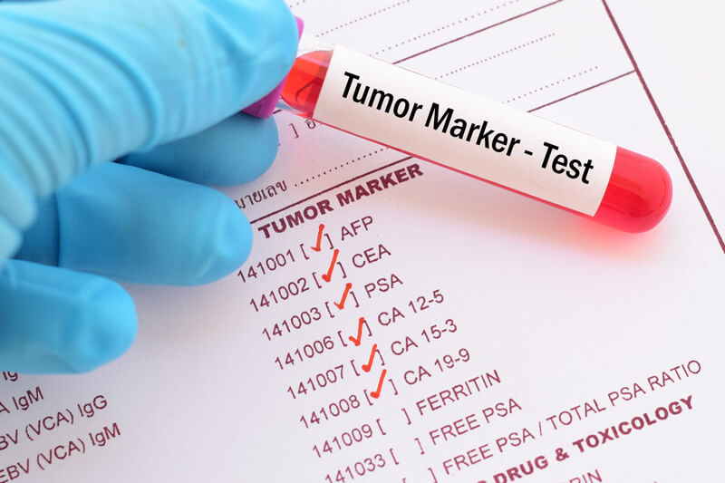 tumormarker vizsgálat vérből